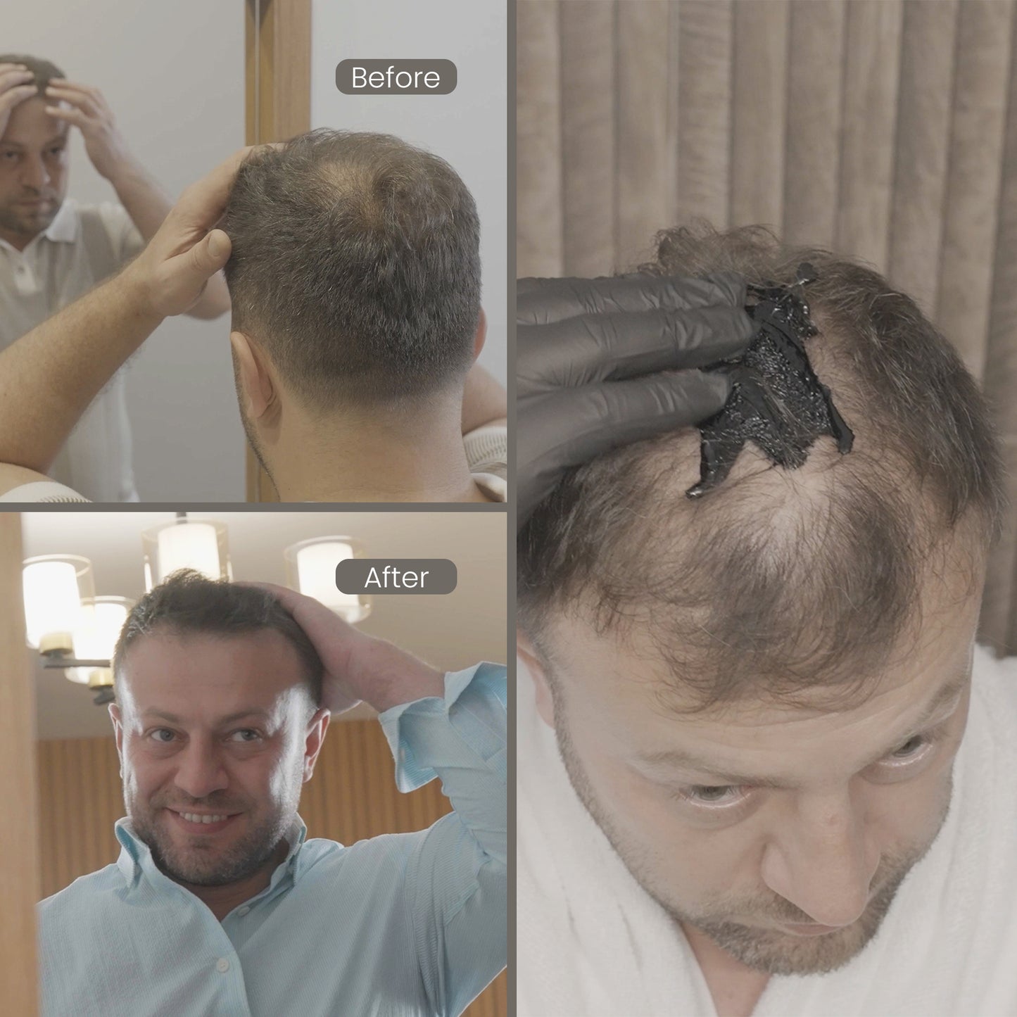 BATCI® Bundle Set - 1x Hair Concealer & Shampoo