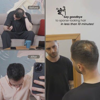 BATCI® Bundle Set - 1x Hair Concealer & Shampoo