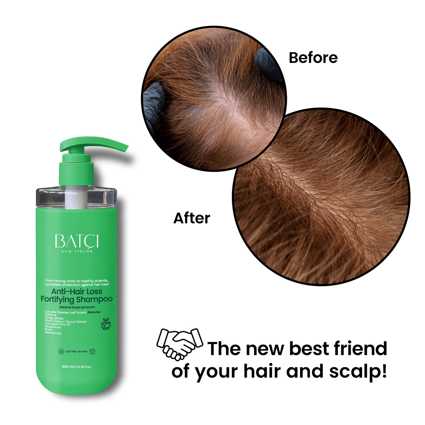 Champú anticaída BATCI® Fórmula nutritiva con extracto de té matcha 500 ml